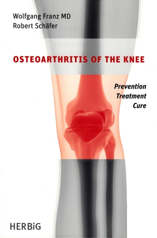 Osteoarthritis of the knee - Wolfgang Franz; Robert Schäfer