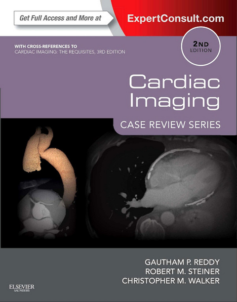 Cardiac Imaging: Case Review Series -  Gautham P. Reddy,  Robert M. Steiner,  Christopher M. Walker