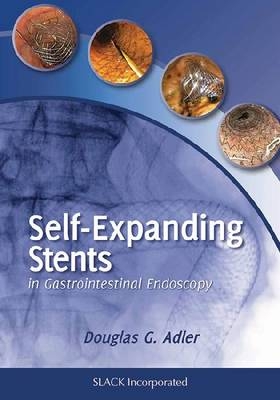 Self Expanding Stents in Gastroenterology -  Doulgas Adler