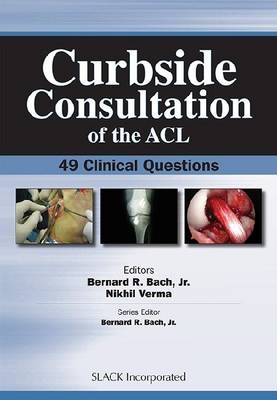 Curbside Consultation of the ACL - 