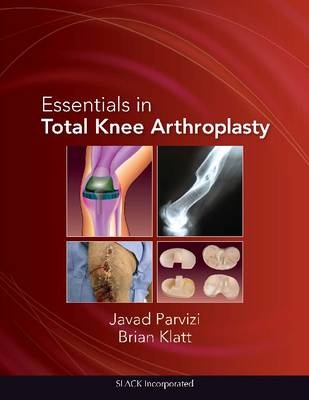 Essentials in Total Knee Arthroplasty - 