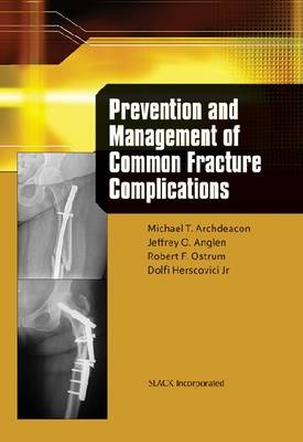 Prevention and Management of Common Fracture Complications - 