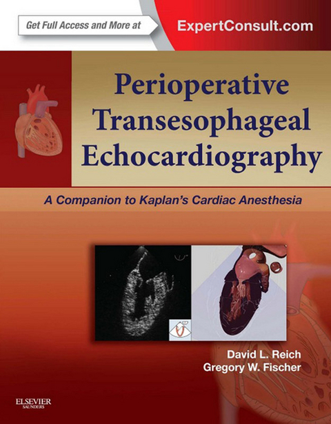 Perioperative Transesophageal Echocardiography -  Gregory Fischer,  David L. Reich