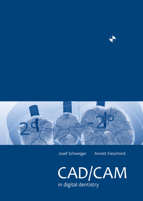 CAD/CAM in digital dentistry