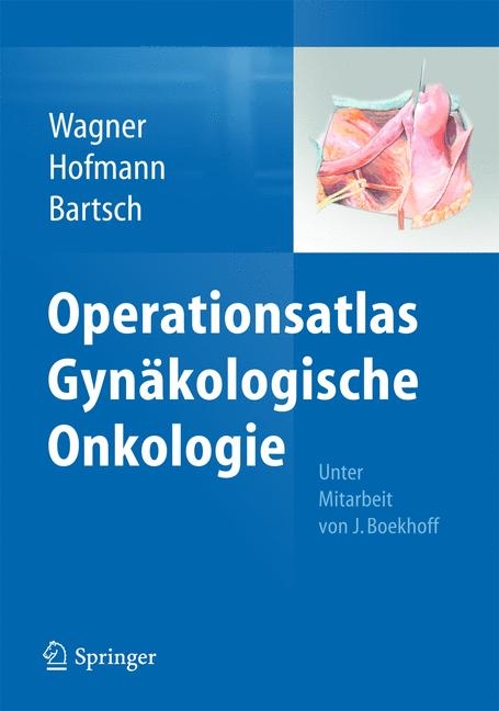 Operationsatlas Gynäkologische Onkologie -  Uwe Wagner,  Rainer Hofmann,  Detlef K. Bartsch,  Jelena Boekhoff