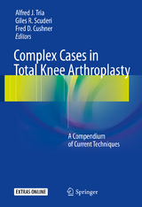 Complex Cases in Total Knee Arthroplasty - 