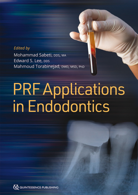 Platelet-Rich Fibrin Prf Applications in Endodontics - Mohammad Sabeti