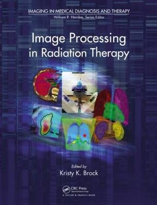 Image Processing in Radiation Therapy - 