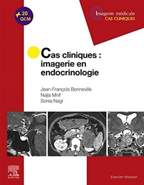Cas cliniques : imagerie en endocrinologie - Jean-François Bonneville, Najla Mnif, S. Nagi