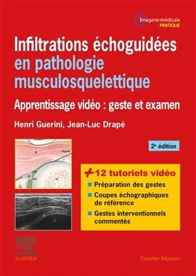 Infiltrations échoguidées en pathologie musculosquelettique : apprentissage vidéo : geste et examen - Jean-Luc Drapé, Henri Guerini