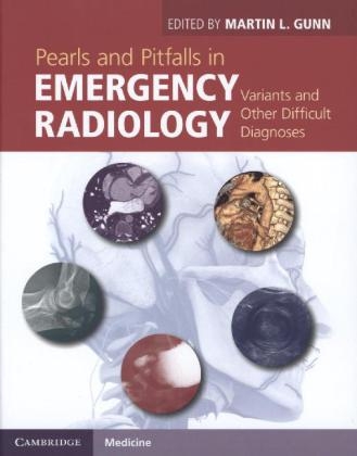 Pearls and Pitfalls in Emergency Radiology - 