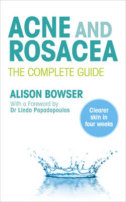 Acne and Rosacea -  Alison Bowser