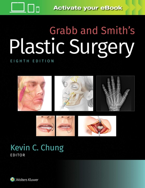 Grabb and Smith's Plastic Surgery - 