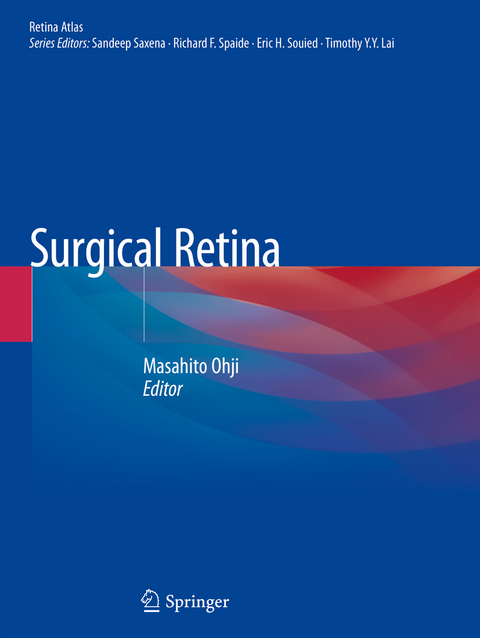 Surgical Retina - 