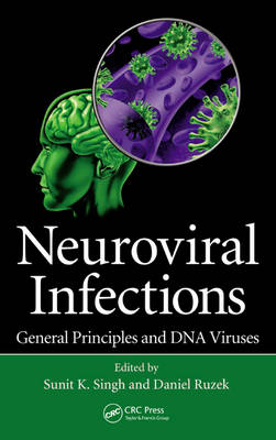 Neuroviral Infections - 