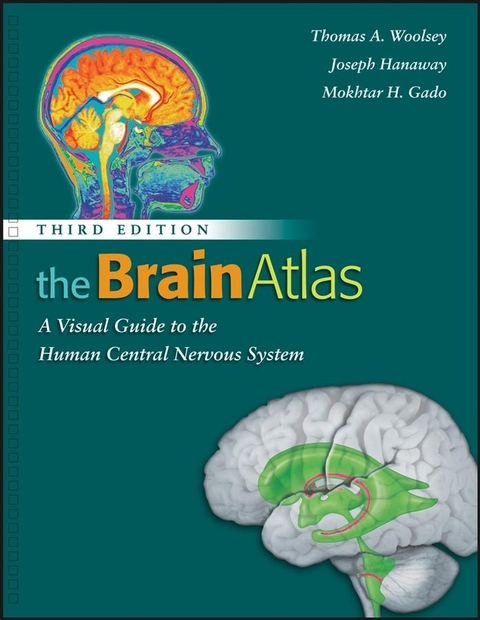 The Brain Atlas - Thomas A. Woolsey, Joseph Hanaway, Mokhtar H. Gado