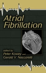 Atrial Fibrillation - 