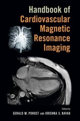 Handbook of Cardiovascular Magnetic Resonance Imaging - 