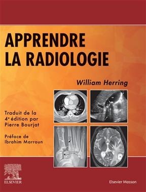 Apprendre la radiologie - William Herring