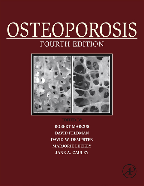 Osteoporosis - 