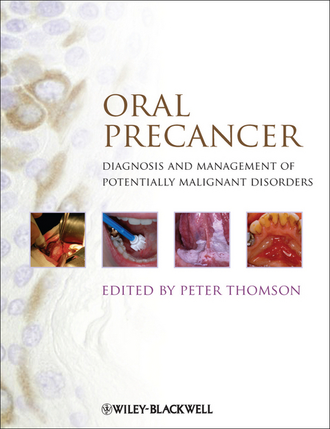 Oral Precancer - 
