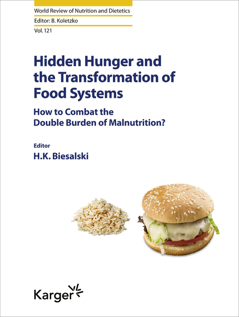 Hidden Hunger and the Transformation of Food Systems - 