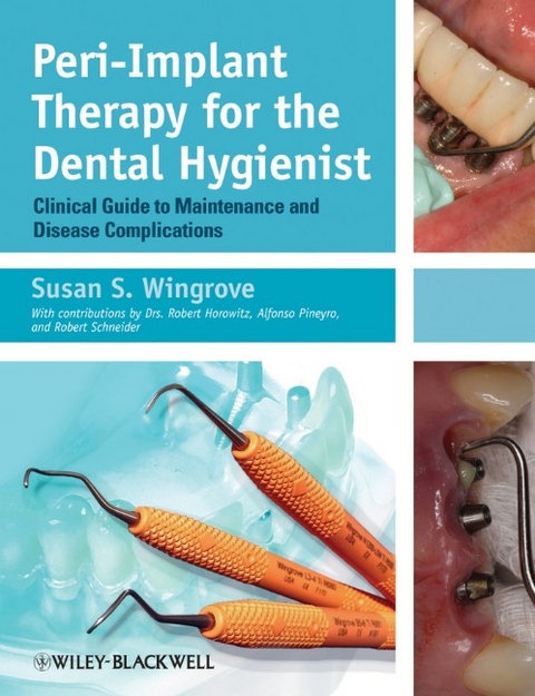 Peri-Implant Therapy for the Dental Hygienist - Susan S. Wingrove