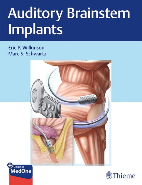 Auditory Brainstem Implants - Eric Wilkinson, Marc Schwartz