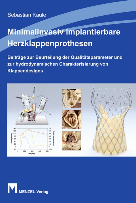 Minimalinvasiv implementierbare Herzklappenprothesen - Sebastian Kaule