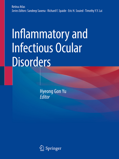 Inflammatory and Infectious Ocular Disorders - 