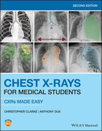 Chest X-Rays for Medical Students - Christopher Clarke, Anthony Dux