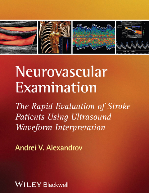 Neurovascular Examination -  Andrei V. Alexandrov