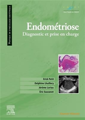 Endométriose : diagnostic et prise en charge - E. Petit, D. Lhuillery, J. Loriau, E. Sauvanet