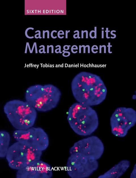 Cancer and its Management -  Daniel Hochhauser,  Jeffrey S. Tobias
