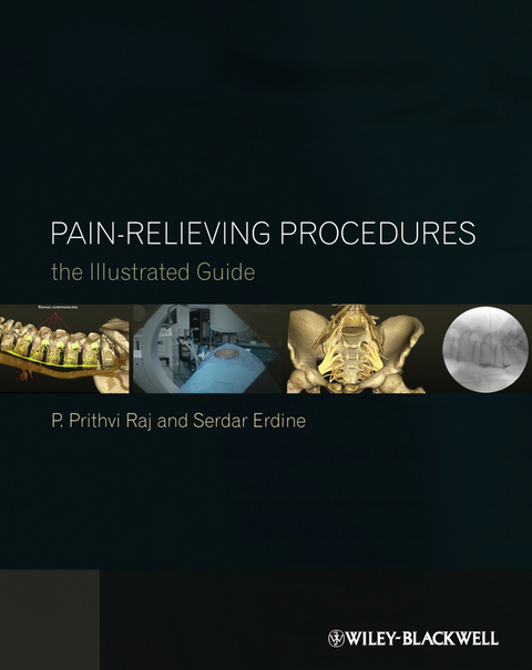 Pain-Relieving Procedures -  Serdar Erdine,  P. Prithvi Raj
