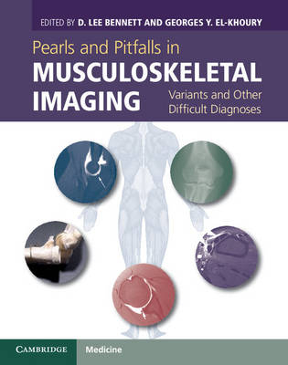 Pearls and Pitfalls in Musculoskeletal Imaging - 