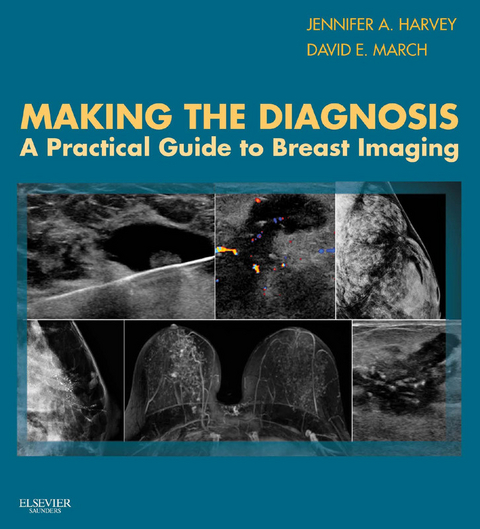 Making the Diagnosis: A Practical Guide to Breast Imaging E-Book -  Jennifer Harvey,  David E March