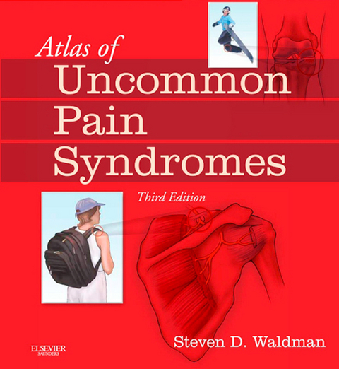 Atlas of Uncommon Pain Syndromes E-Book -  Steven D. Waldman