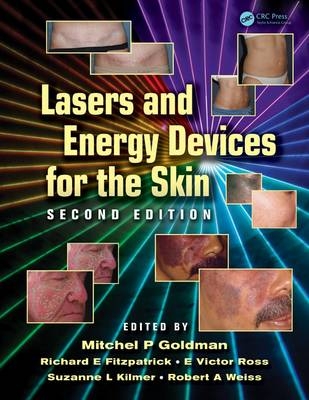 Lasers and Energy Devices for the Skin - 