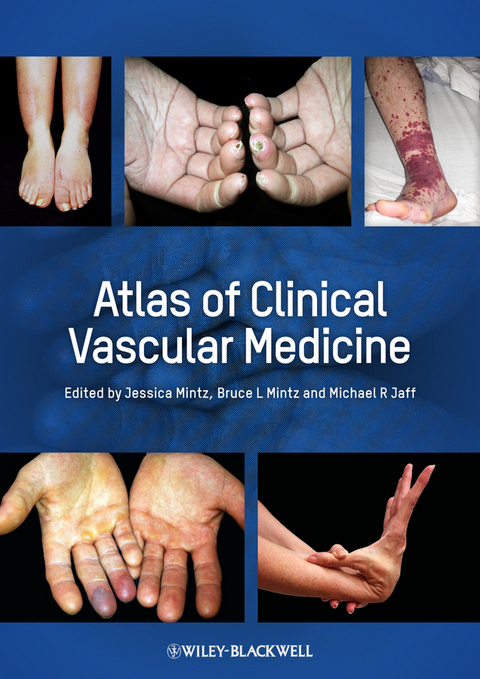 Atlas of Clinical Vascular Medicine - 