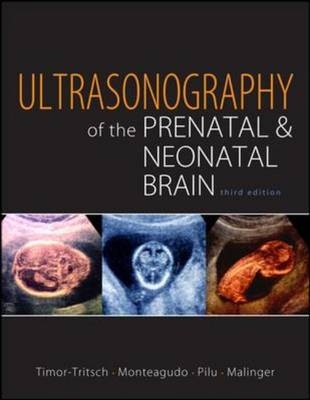 Ultrasonography of the Prenatal Brain, Third Edition -  Gustavo Malinger,  Ana Monteagudo,  Gianluigi Pilu,  Ilan Timor-Tritsch