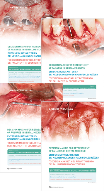 Decision making for retreatment of failures in dental medicine - Giorgio Tabanella