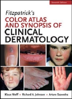 Fitzpatricks Color Atlas and Synopsis of Clinical Dermatology, Seventh Edition -  Richard Allen Johnson,  Arturo Saavedra,  Klaus Wolff