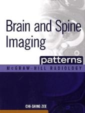 Brain and Spine Imaging Patterns -  Chi-Shing Zee