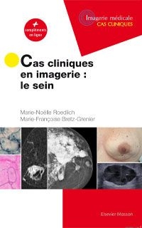 Cas cliniques en imagerie : le sein : + compléments en ligne - Marie-Noëlle Roedlich, M.-F. Bretz-Grenier