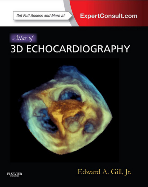 Atlas of 3D Echocardiography -  Edward A. Gill