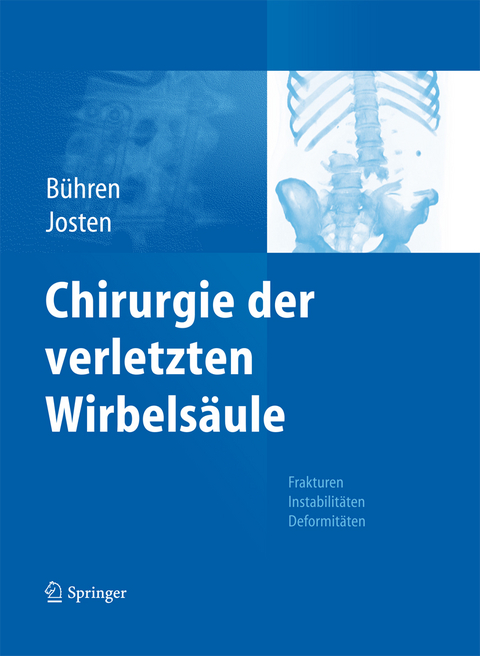Chirurgie der verletzten Wirbelsäule -  Volker Bühren,  Christoph Josten