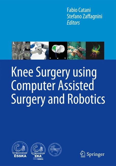 Knee Surgery using Computer Assisted Surgery and Robotics - 