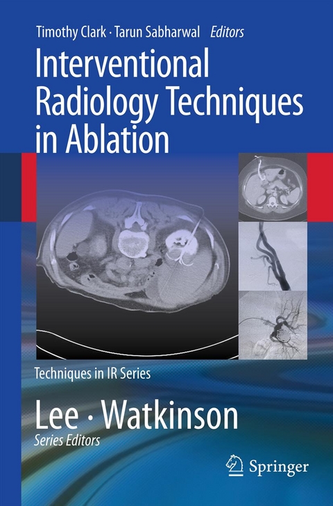 Interventional Radiology Techniques in Ablation - 