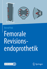 Femorale Revisionsendoprothetik - Bernd Fink